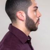 Beard Micropigmentation-A non-surgical treatment for covering patchy areas in the beard-An Overview