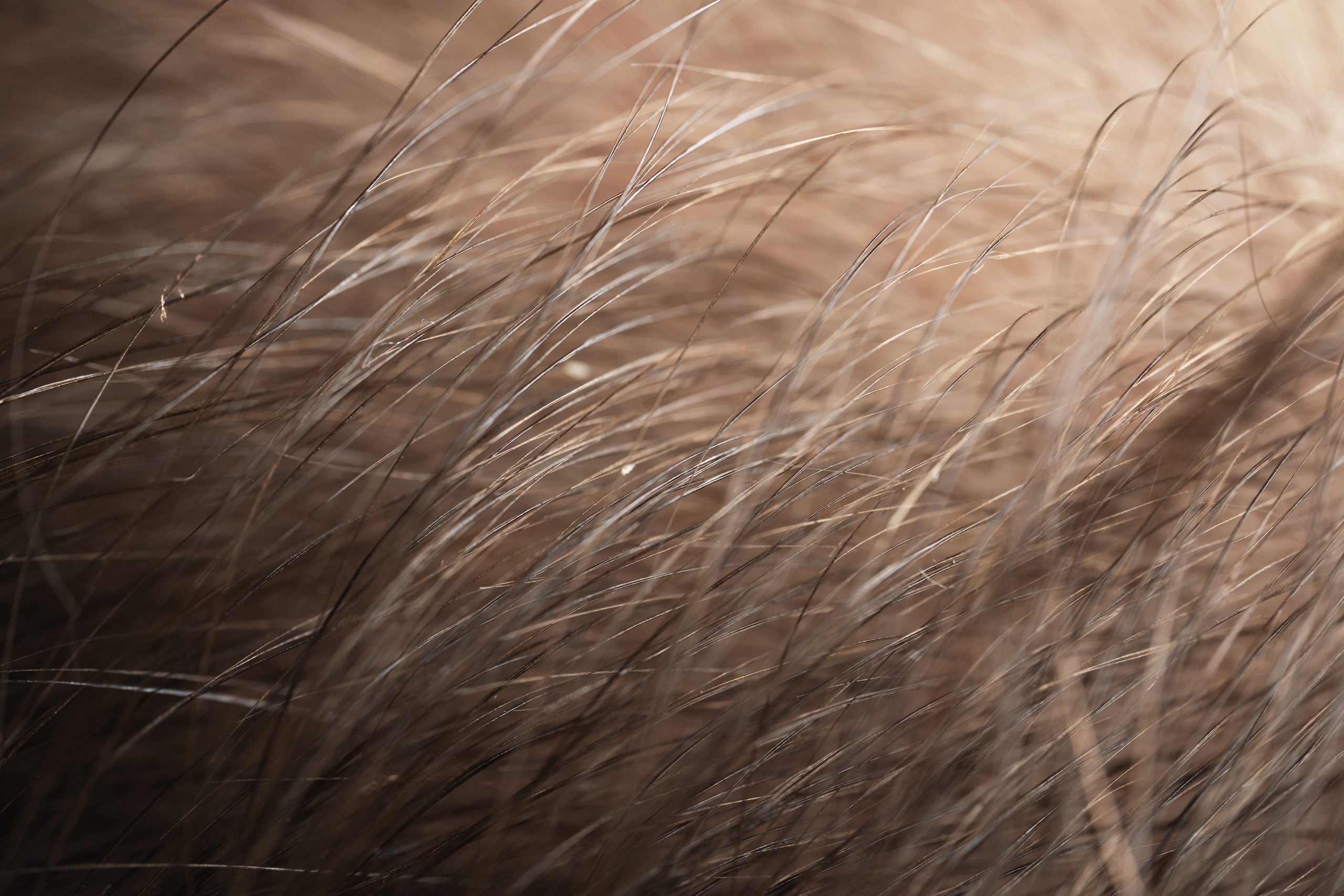 Trichoscopy for hair thinning Dubai