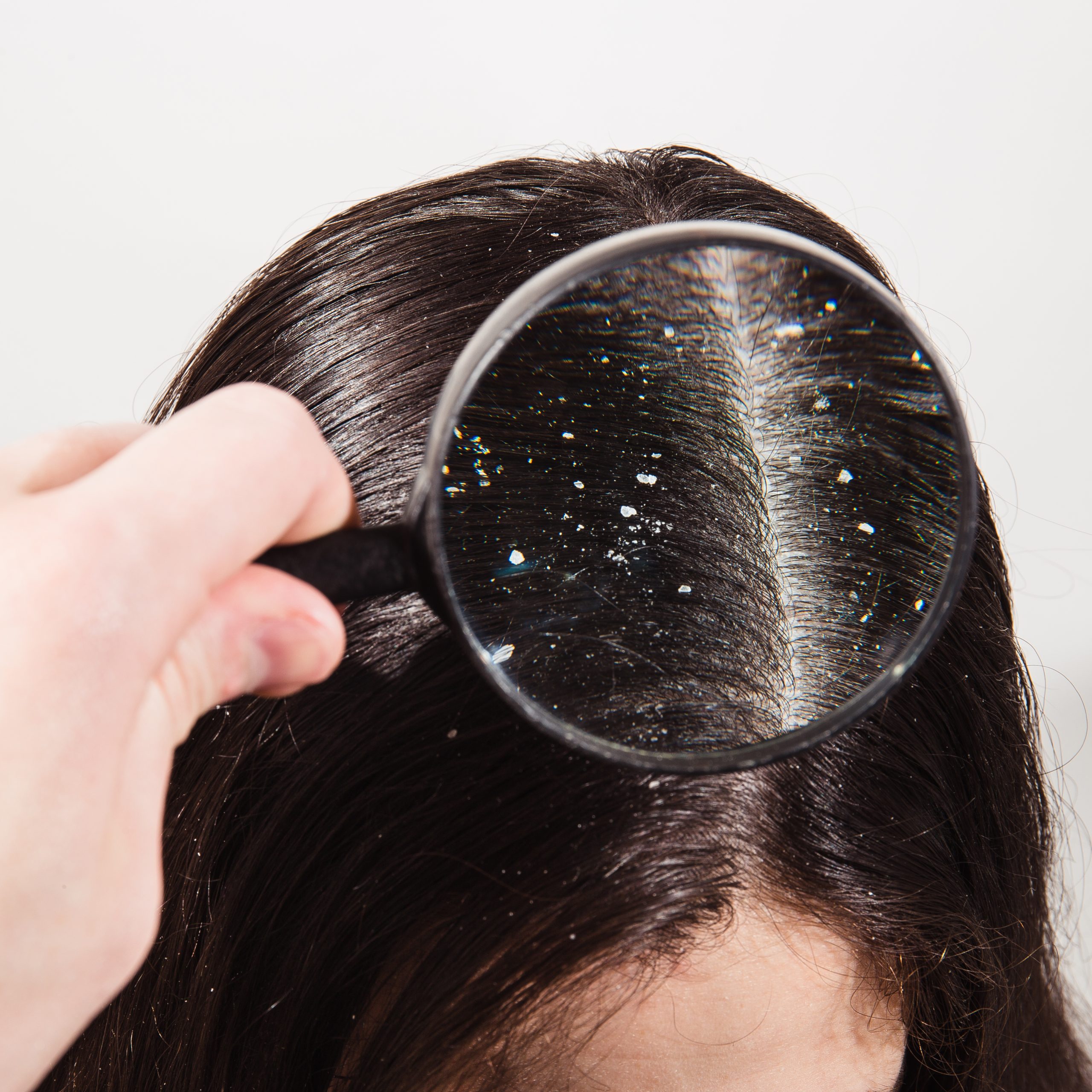 Scalp treatment at Hortman Clinic