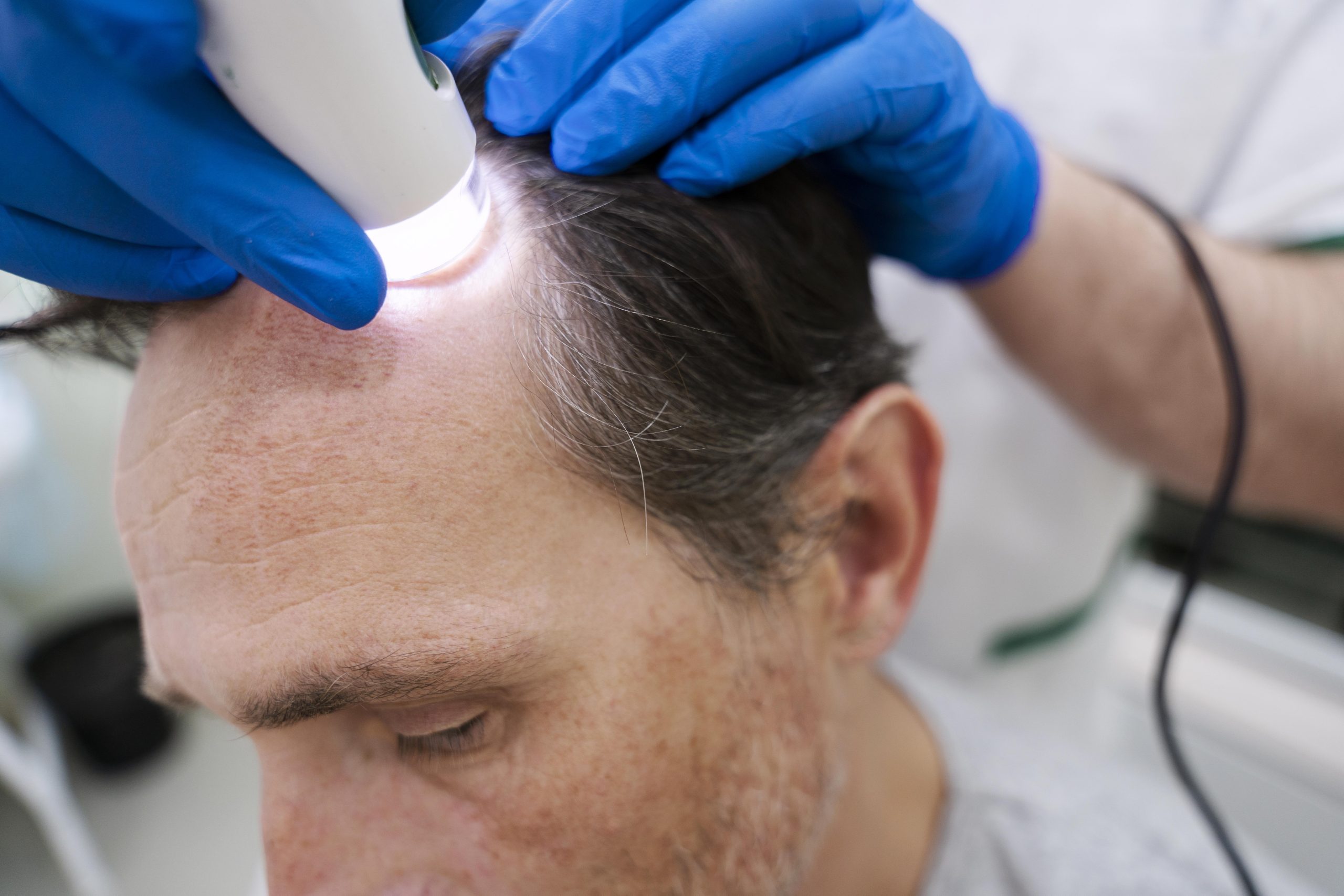 LLLT treatment at Hortman Clinic