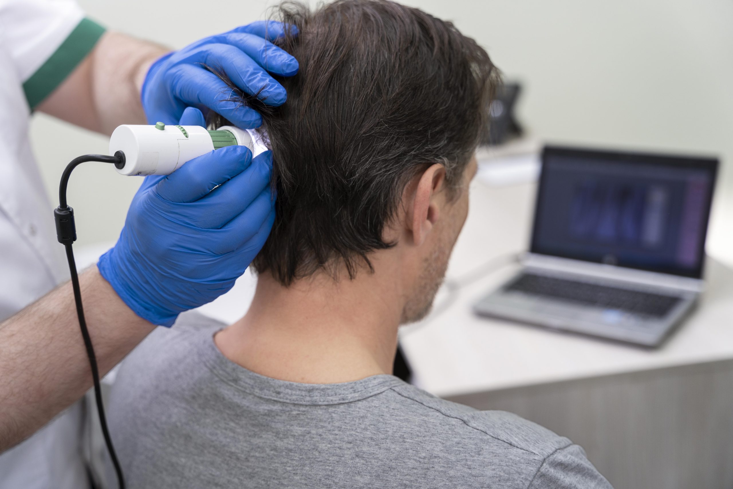 Trichoscopy examination for androgenetic alopecia