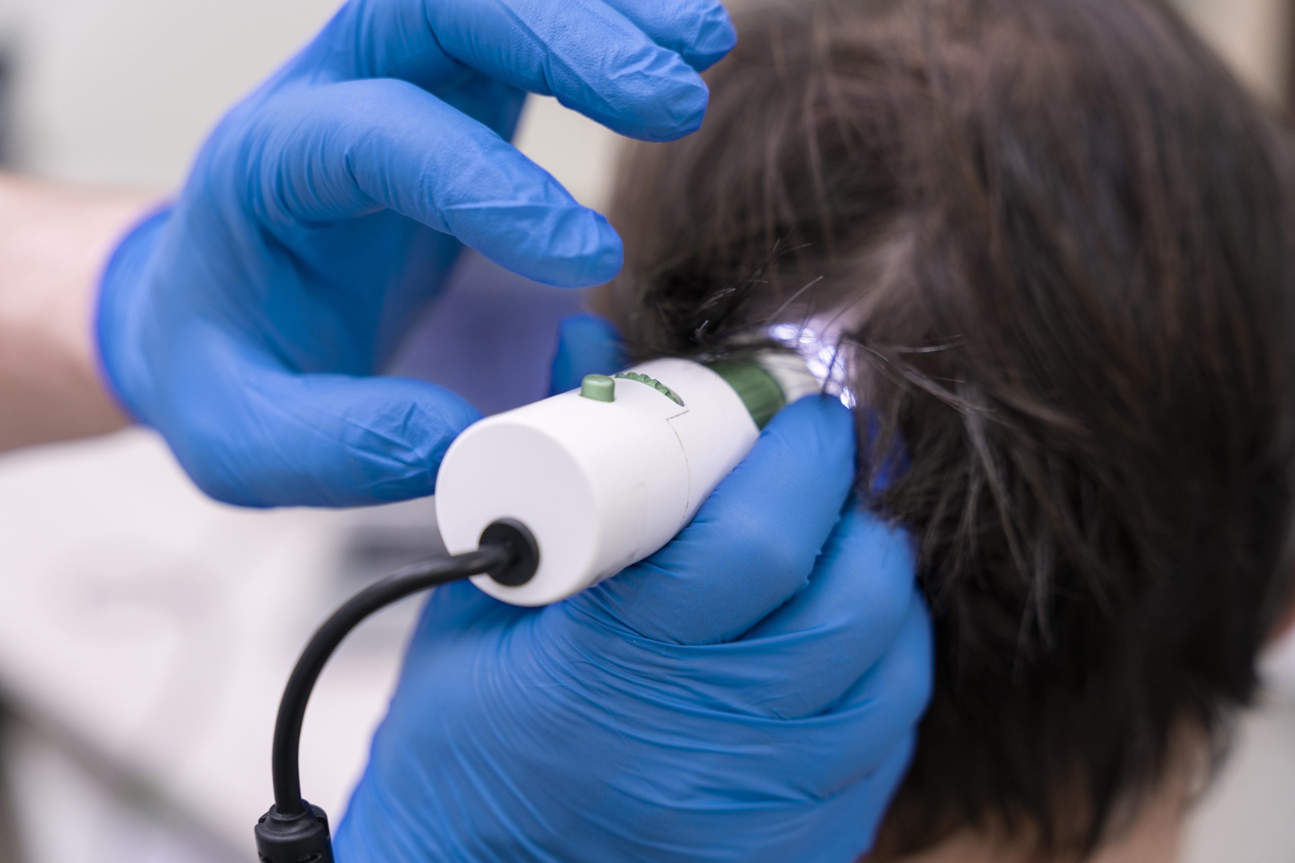 Low-Level Laser Therapy at Hortman Clinic Dubai