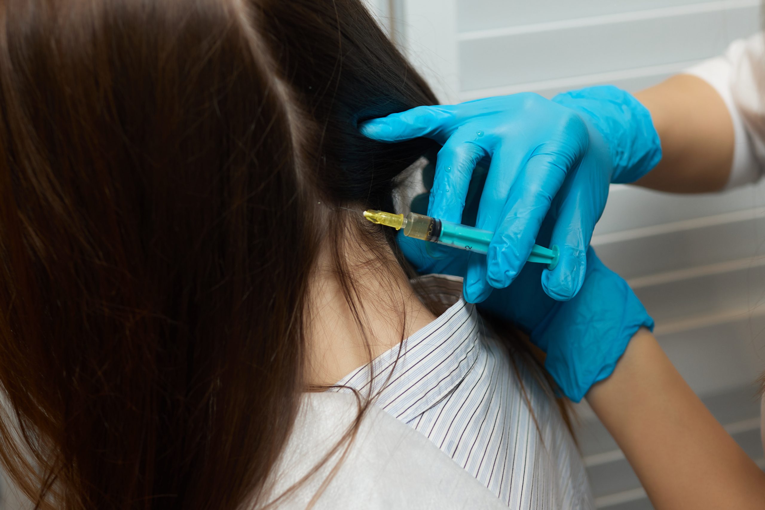 Exosome Mesotherapy at Hortman Clinic Dubai