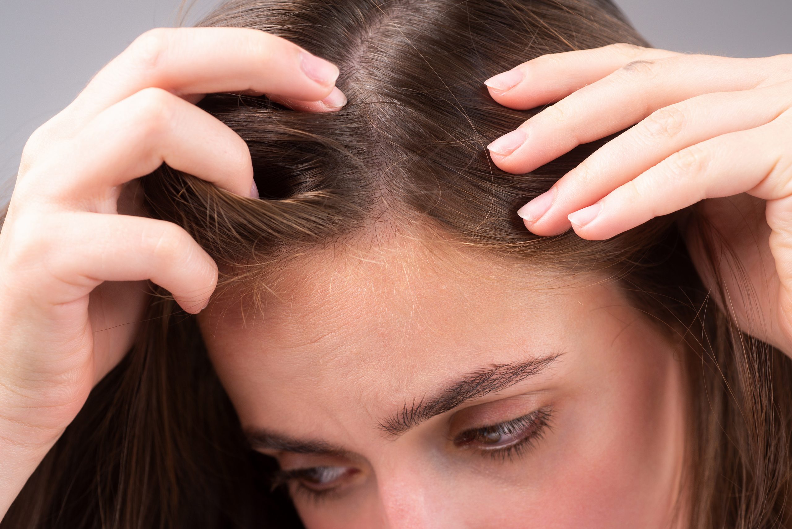 Female hair loss assessment Dubai